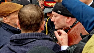 Miniatura: Rewolucja wymaga ofiar