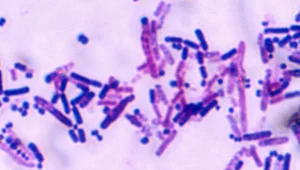 Miniatura: Legionella. Nie żyje już 19 osób