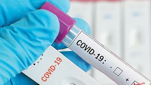 Miniatura: Holandia: Rząd finansuje testy na COVID-19...