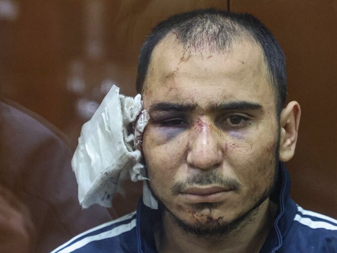 Raczabalizodu Saidakrami Murodali, jeden z podejrzanych o udział w ataku terrorystycznym pod Moskwą, który miał stracić ucho w wyniku tortur