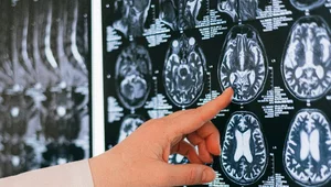 Miniatura: Eksperyment pokazał, jak koronawirus...