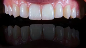 Miniatura: USA wycofają produkty zawierające...