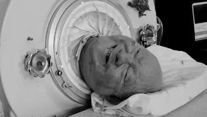 Miniatura: Zmarł Paul Alexander. Przez 70 lat był...