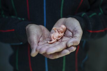 Australia. Działacz pro-life John Preston trzymający model dziecka w dwunastym tygodniu ciąży.