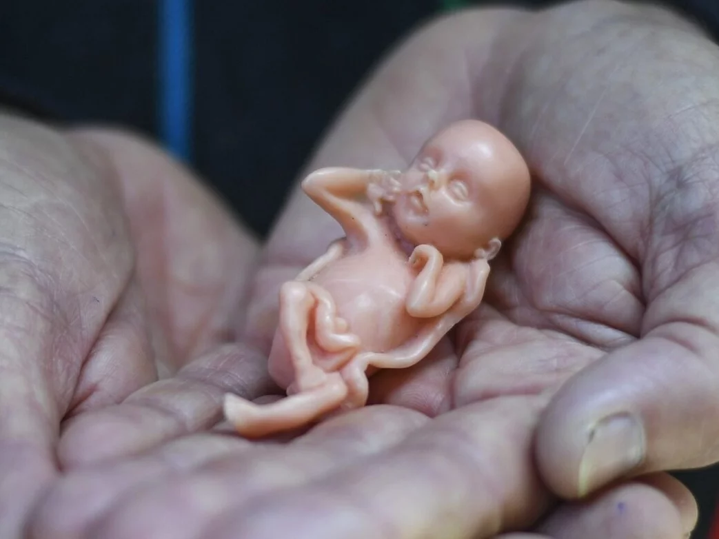 Australia. Działacz pro-life John Preston trzymający model dziecka w dwunastym tygodniu ciąży.