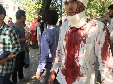Kabul, mężczyzna ranny w dzisiejszym zamachu