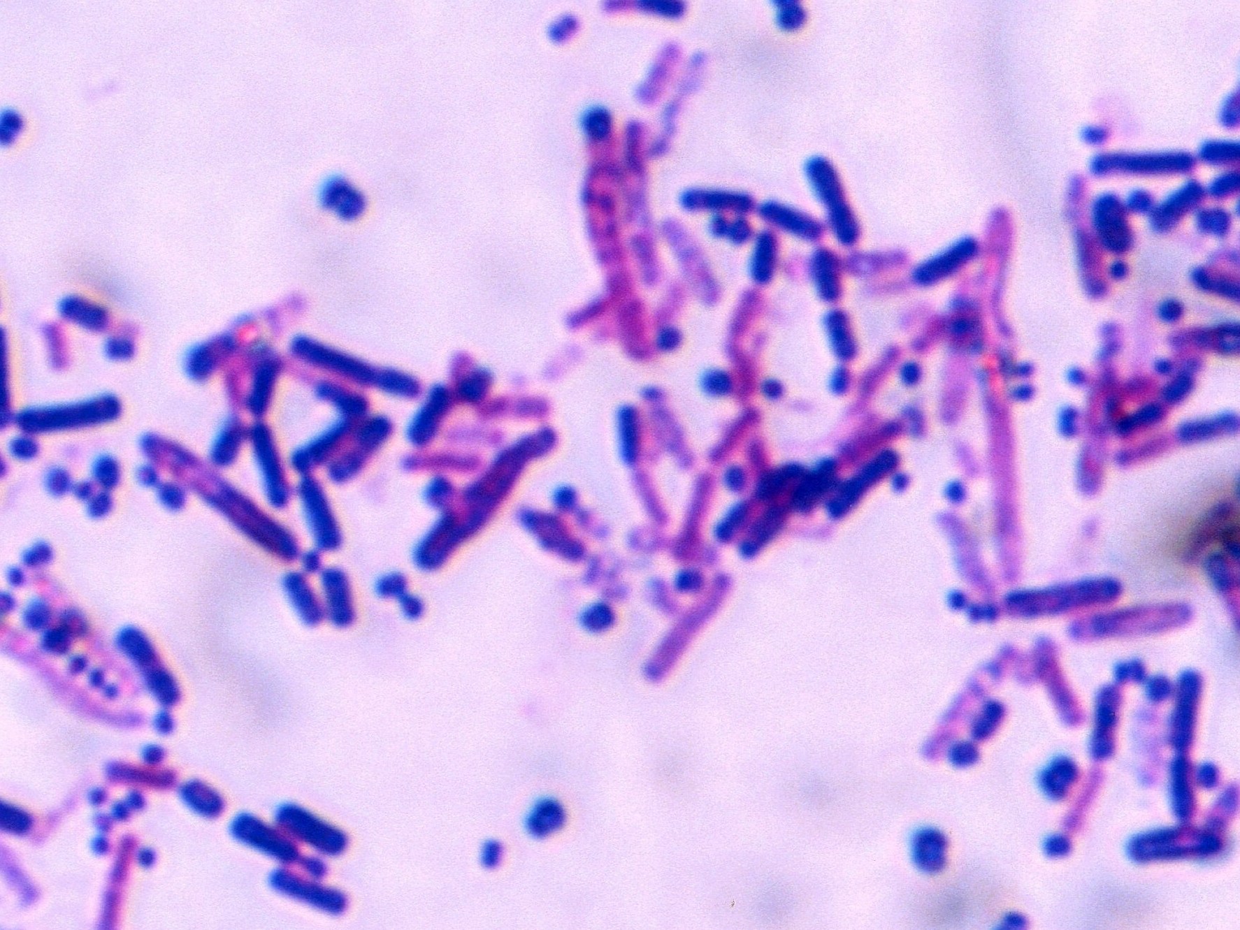 Legionella, zdjęcie ilustracyjne