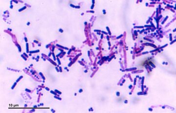 Legionella, zdjęcie ilustracyjne
