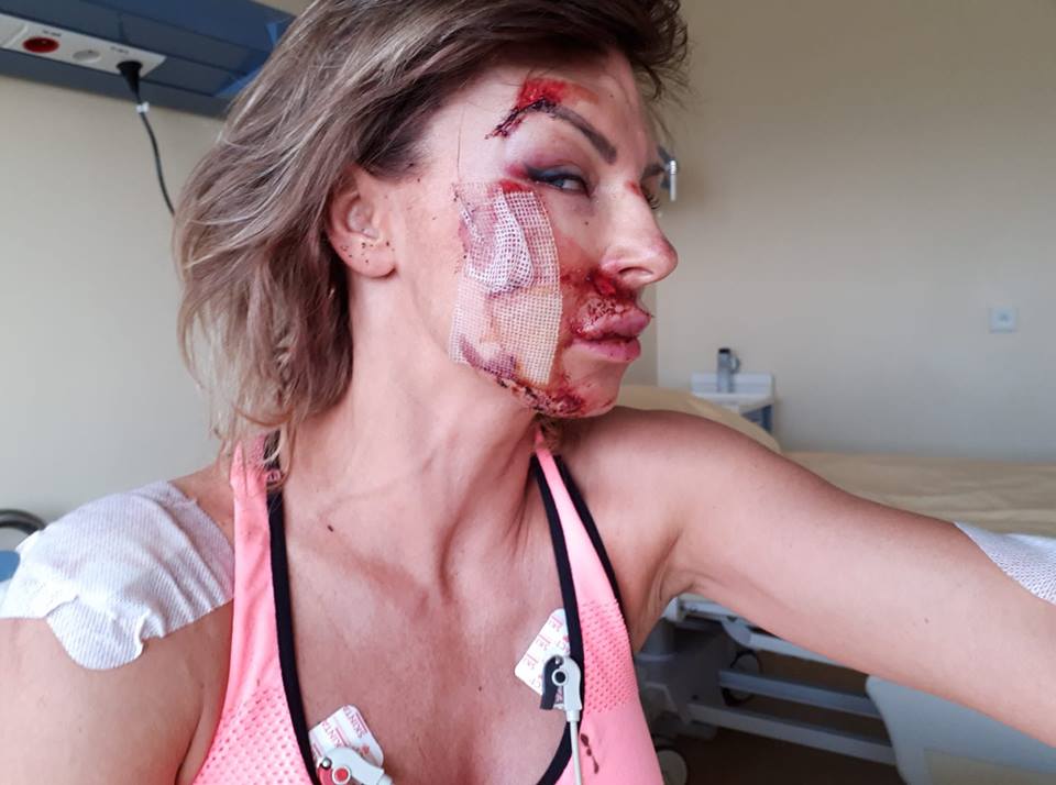 Beata Wiater po wypadku