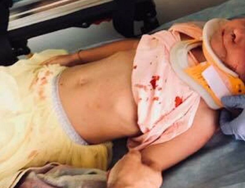 4-latka potrącona przez rowerzystkę