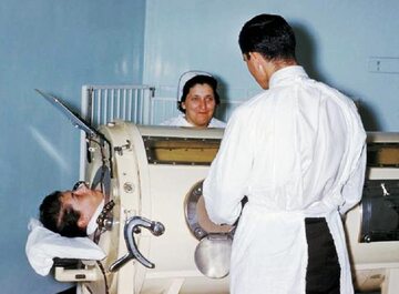 Tzw. żelazne płuco - w ten sposób ratowano najciężej chorych na polio.