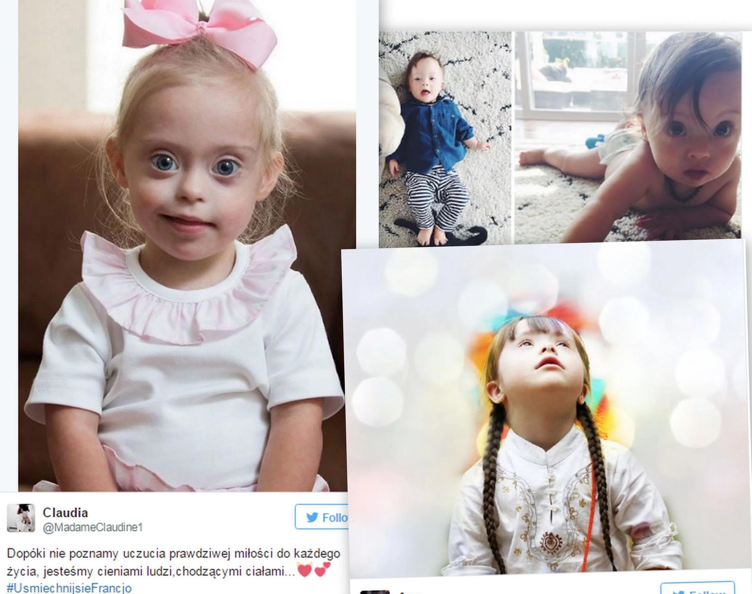 Osoby z zespołem Downa cenzurowane we Francji